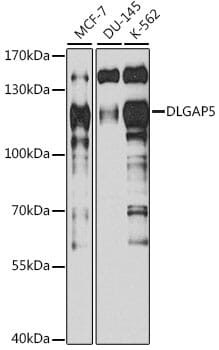 Western blot analysis of extracts of various cell lines, using Anti-DLGAP5 Antibody (A13575) at 1:1,000 dilution.
Secondary antibody: HRP Goat Anti-Mouse IgG (H+L) (AS003) at 1:10,000 dilution.
Lysates / proteins: 25µg per lane.
Blocking buffer: 3% non-fat dry milk in TBST.
Detection: ECL Basic Kit (RM00020).
Exposure time: 90s.