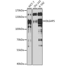 Western Blot - Anti-HURP Antibody (A92452) - Antibodies.com