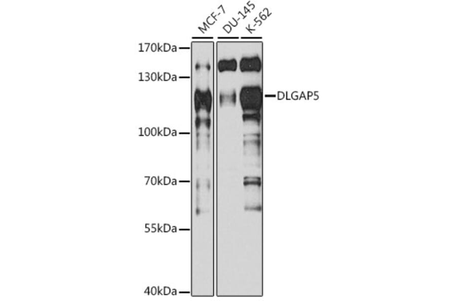 Western Blot - Anti-HURP Antibody (A92452) - Antibodies.com