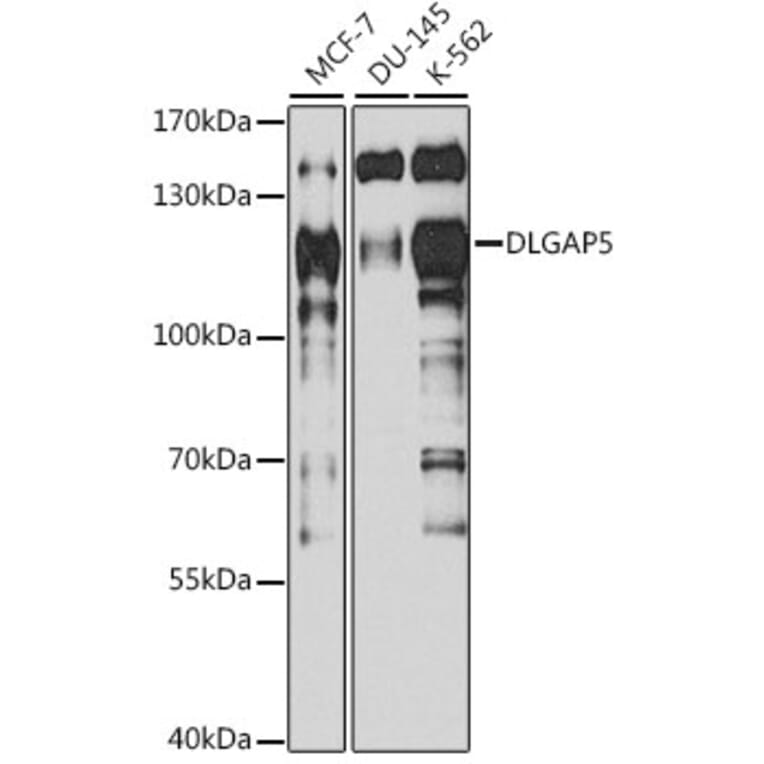 Western Blot - Anti-HURP Antibody (A92452) - Antibodies.com