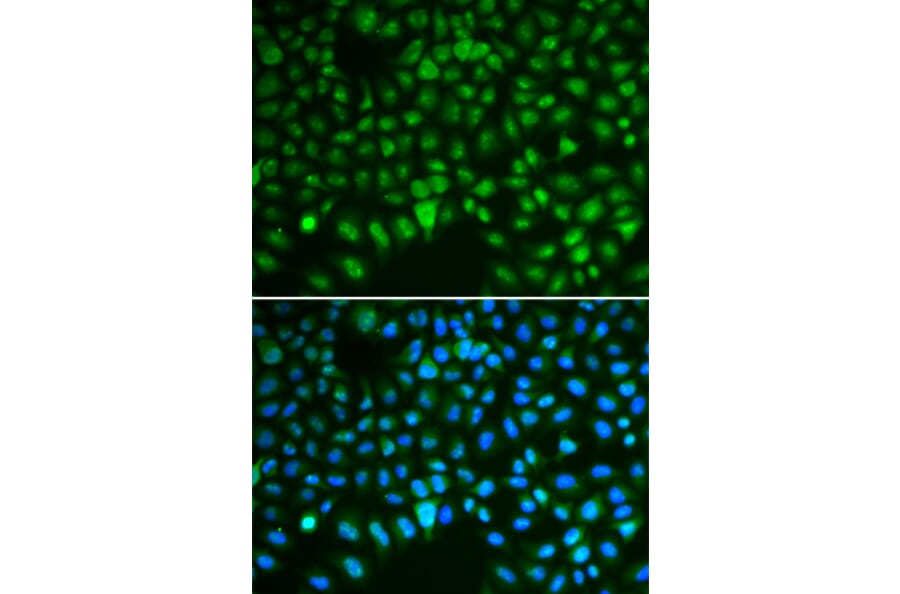 Immunofluorescence - Anti-HURP Antibody (A92452) - Antibodies.com