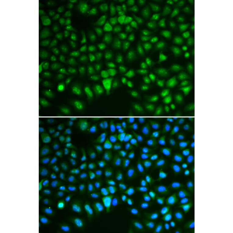 Immunofluorescence - Anti-HURP Antibody (A92452) - Antibodies.com