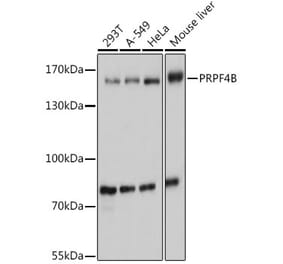Western Blot - Anti-PRPF4B Antibody (A92453) - Antibodies.com