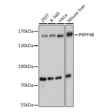 Western Blot - Anti-PRPF4B Antibody (A92453) - Antibodies.com