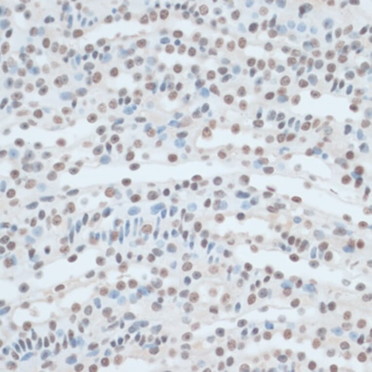 Immunohistochemistry - Anti-ZNF433 Antibody (A92455) - Antibodies.com