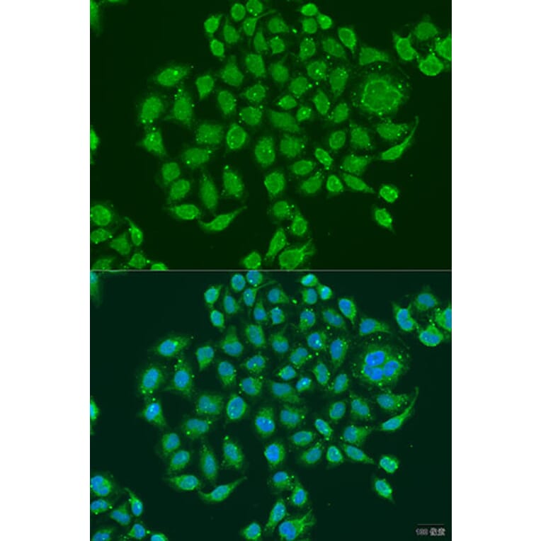 Immunofluorescence - Anti-PRDM10 Antibody (A15176) - Antibodies.com