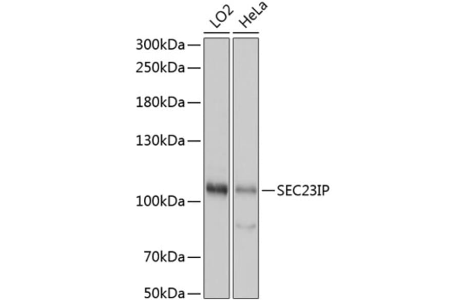 Western Blot - Anti-SEC23IP Antibody (A92461) - Antibodies.com