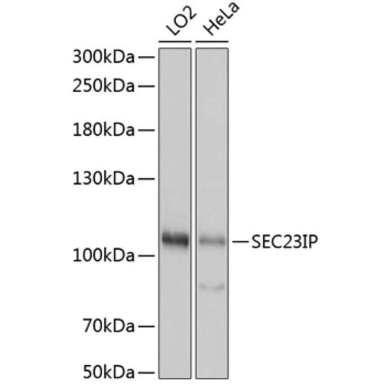 Western Blot - Anti-SEC23IP Antibody (A92461) - Antibodies.com