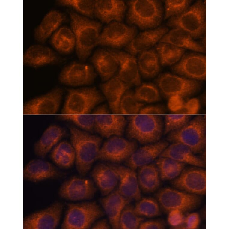 Immunofluorescence - Anti-SEC23IP Antibody (A92461) - Antibodies.com