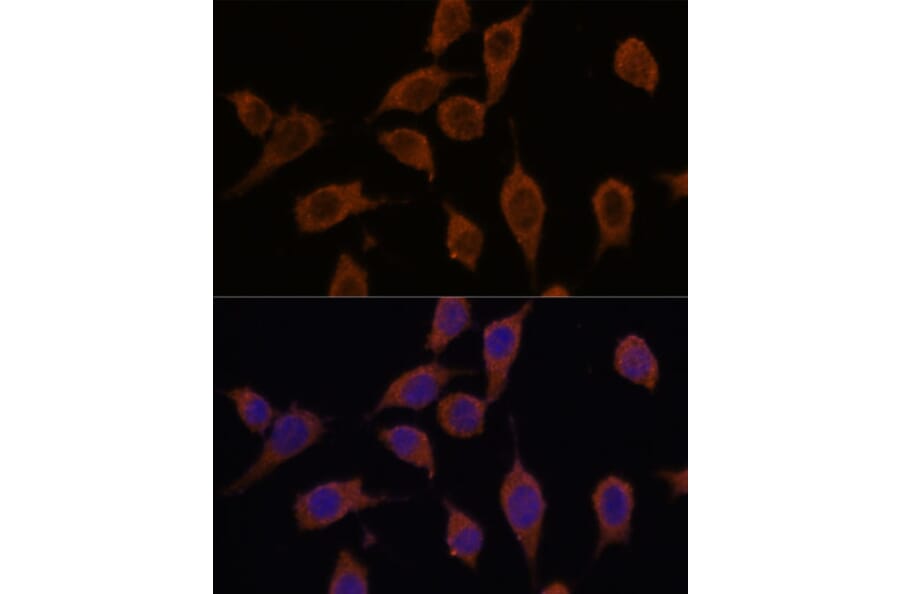 Immunofluorescence - Anti-SEC23IP Antibody (A92461) - Antibodies.com