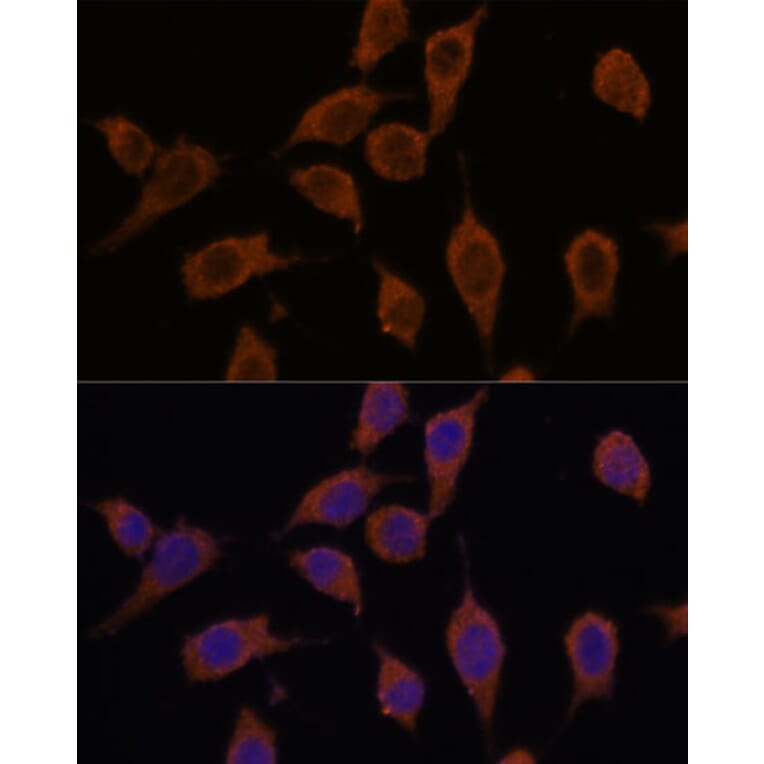 Immunofluorescence - Anti-SEC23IP Antibody (A92461) - Antibodies.com