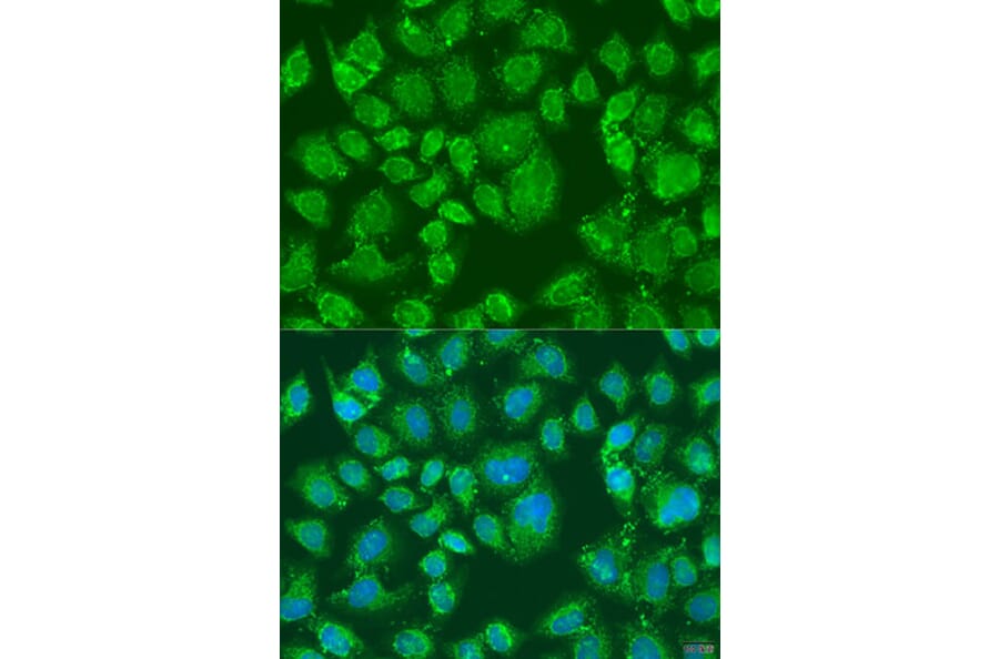 Immunofluorescence - Anti-PFKL Antibody (A15080) - Antibodies.com