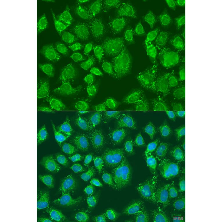 Immunofluorescence - Anti-PFKL Antibody (A15080) - Antibodies.com
