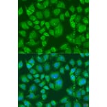 Immunofluorescence - Anti-PFKL Antibody (A15080) - Antibodies.com