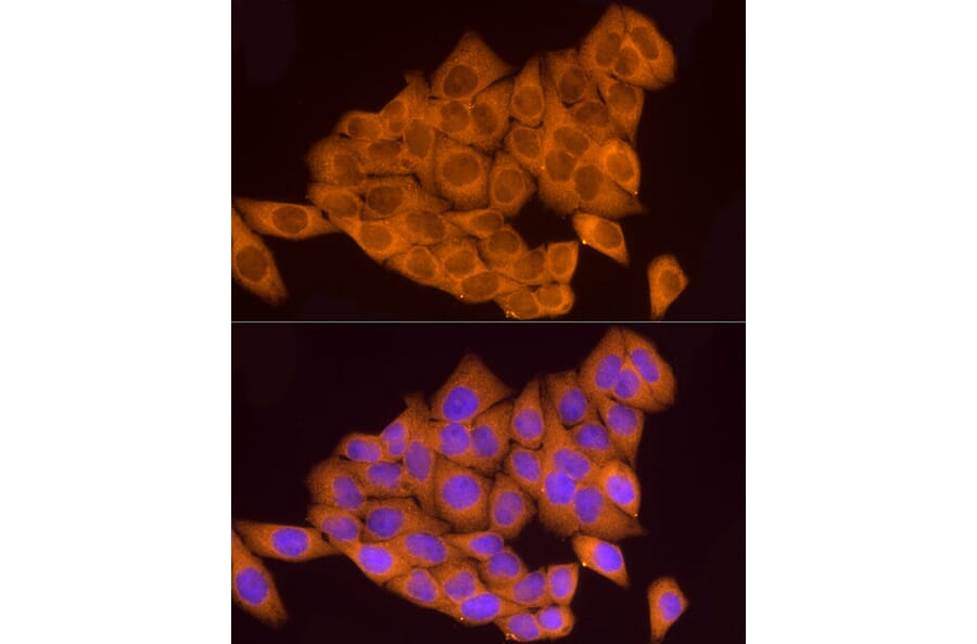 Immunofluorescence - Anti-ATP6V0A1 Antibody (A92464) - Antibodies.com