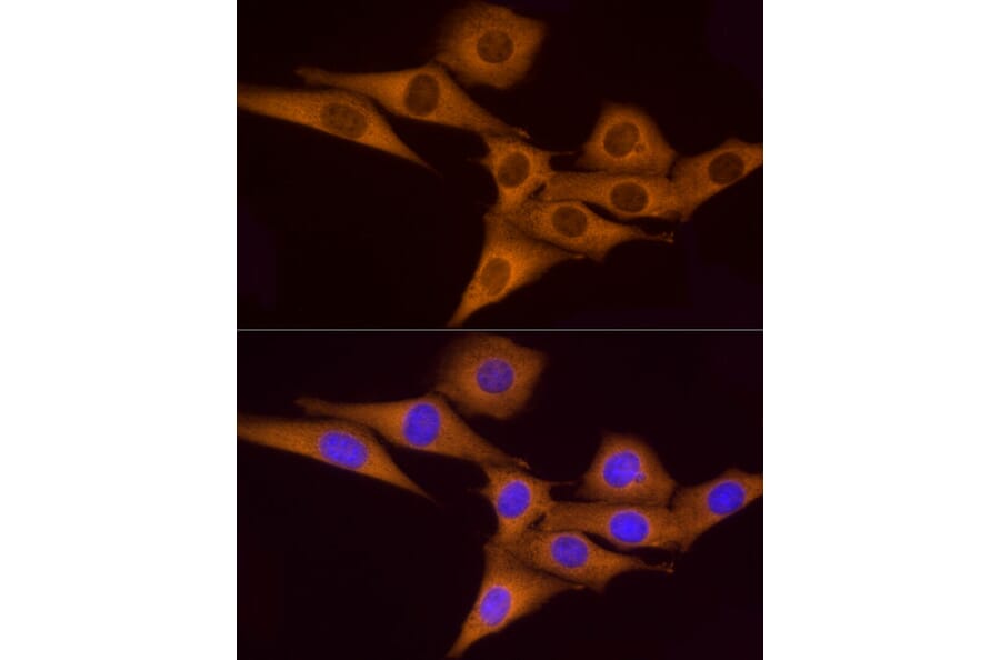Immunofluorescence - Anti-ATP6V0A1 Antibody (A92464) - Antibodies.com