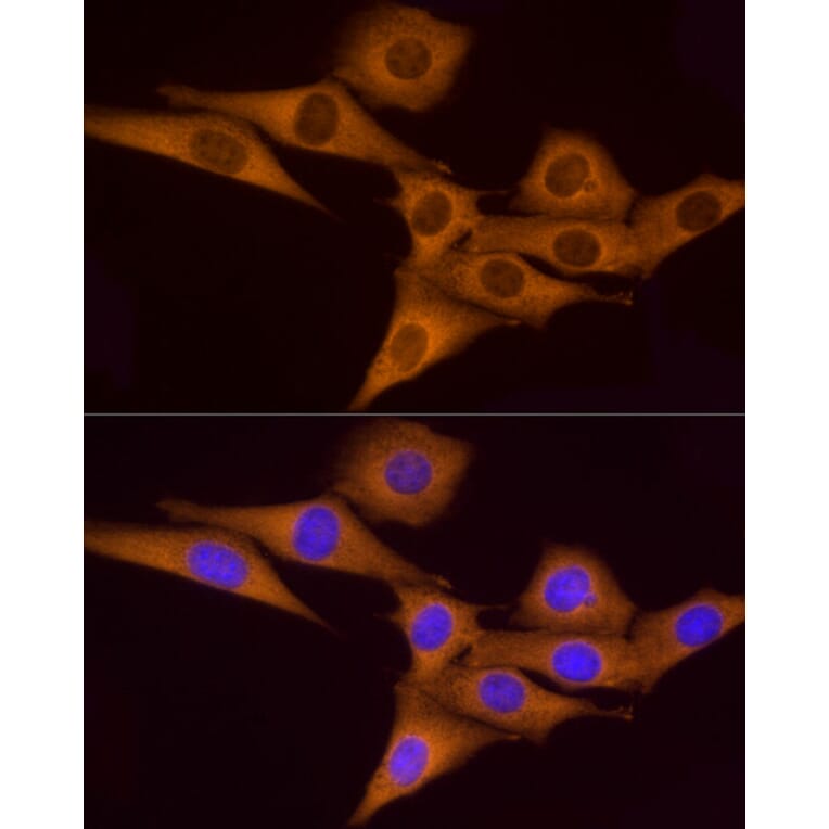 Immunofluorescence - Anti-ATP6V0A1 Antibody (A92464) - Antibodies.com