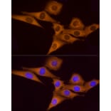 Immunofluorescence - Anti-ATP6V0A1 Antibody (A92464) - Antibodies.com