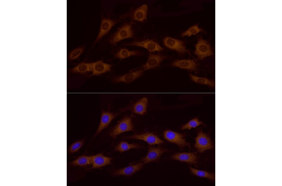 Immunofluorescence - Anti-ATP6V0A1 Antibody (A92464) - Antibodies.com