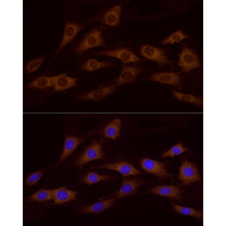 Immunofluorescence - Anti-ATP6V0A1 Antibody (A92464) - Antibodies.com