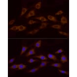 Immunofluorescence - Anti-ATP6V0A1 Antibody (A92464) - Antibodies.com
