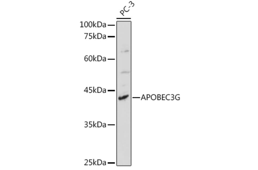 Western Blot - Anti-APOBEC3G/A3G Antibody (A92465) - Antibodies.com