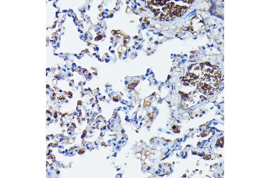 Immunohistochemistry - Anti-APOBEC3G/A3G Antibody (A92465) - Antibodies.com