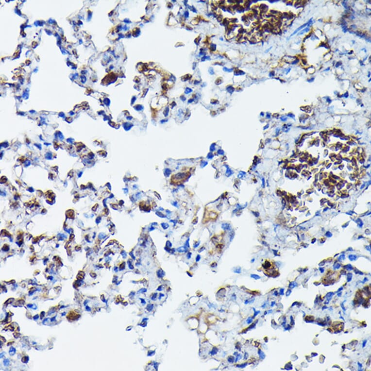 Immunohistochemistry - Anti-APOBEC3G/A3G Antibody (A92465) - Antibodies.com