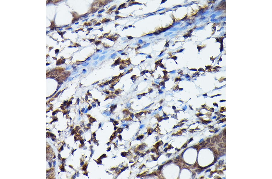 Immunohistochemistry - Anti-APOBEC3G/A3G Antibody (A92465) - Antibodies.com