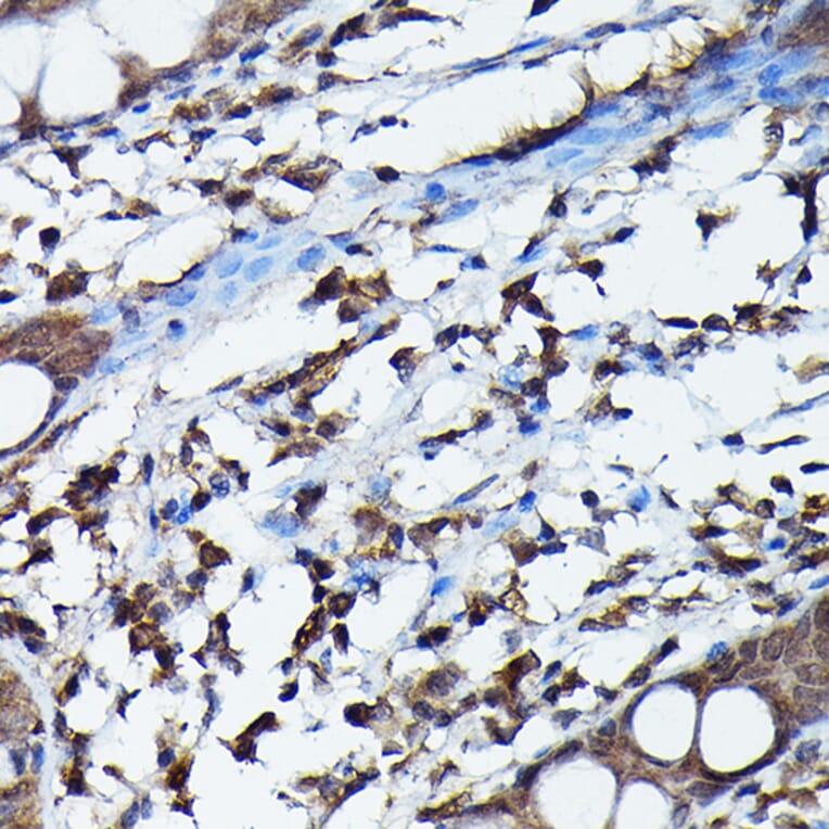 Immunohistochemistry - Anti-APOBEC3G/A3G Antibody (A92465) - Antibodies.com