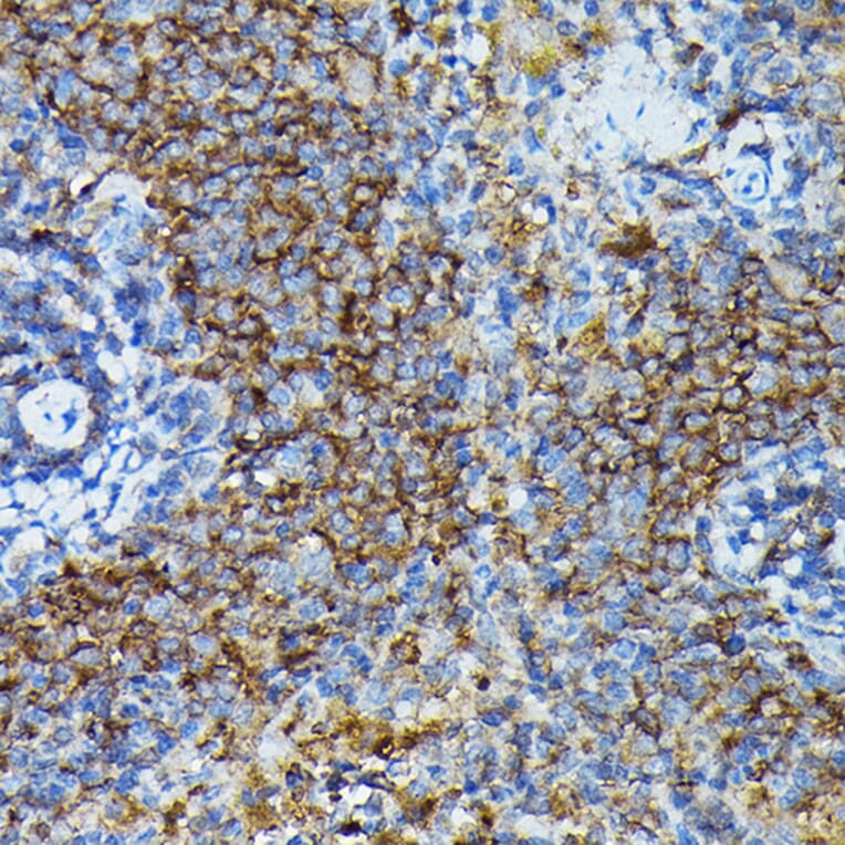 Immunohistochemistry - Anti-APOBEC3G/A3G Antibody (A92465) - Antibodies.com