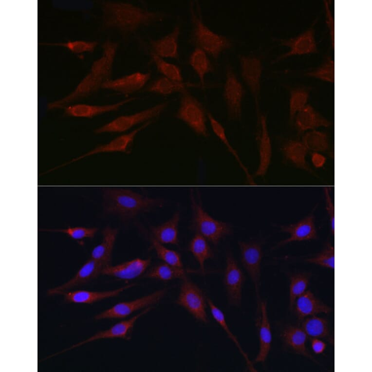 Immunofluorescence - Anti-APOBEC3G/A3G Antibody (A92465) - Antibodies.com