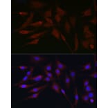 Immunofluorescence - Anti-APOBEC3G/A3G Antibody (A92465) - Antibodies.com