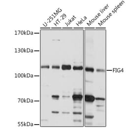 Western Blot - Anti-FIG4 Antibody (A92466) - Antibodies.com