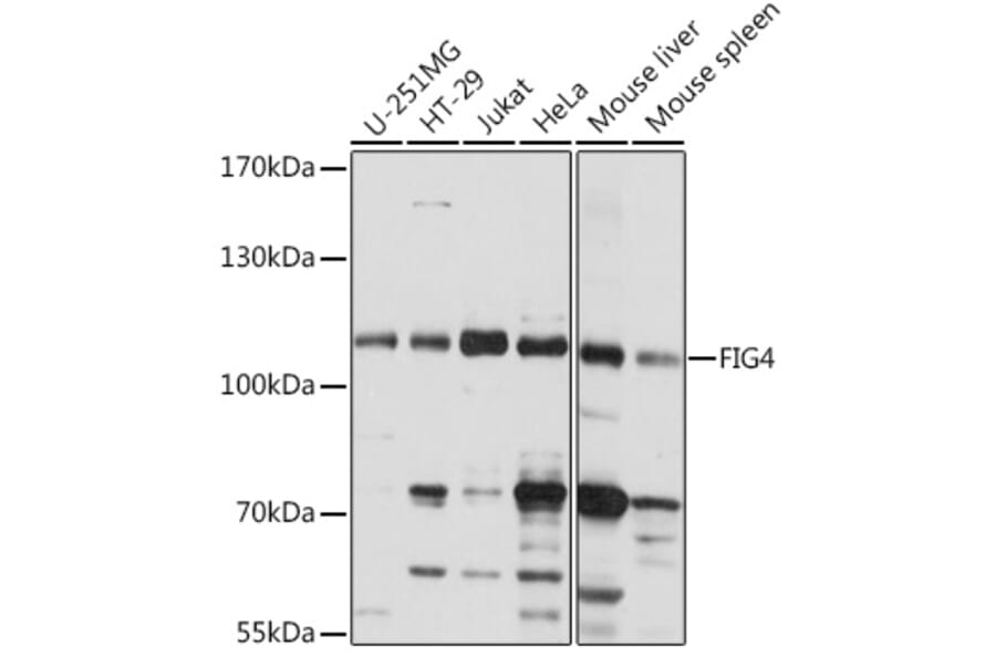 Western Blot - Anti-FIG4 Antibody (A92466) - Antibodies.com