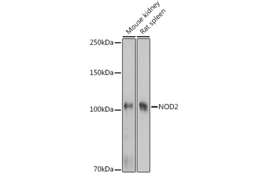 Western Blot - Anti-CARD15/NOD2 Antibody (A92467) - Antibodies.com