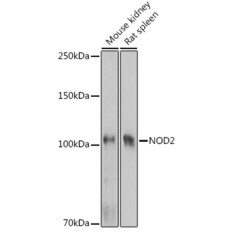 Western Blot - Anti-CARD15/NOD2 Antibody (A92467) - Antibodies.com