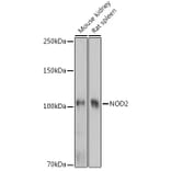 Western Blot - Anti-CARD15/NOD2 Antibody (A92467) - Antibodies.com