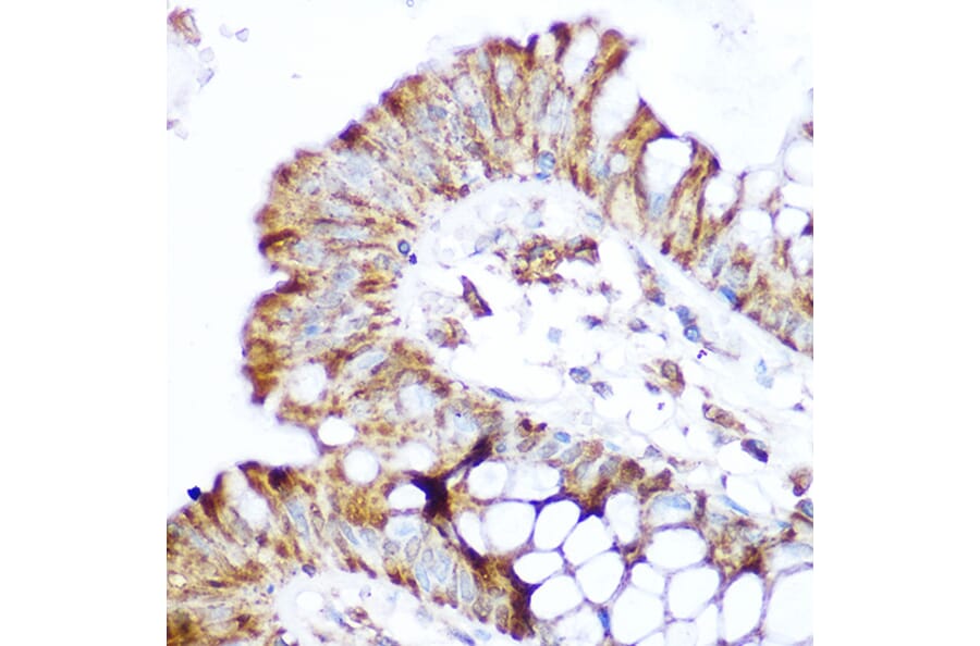 Immunohistochemistry - Anti-CARD15/NOD2 Antibody (A92467) - Antibodies.com