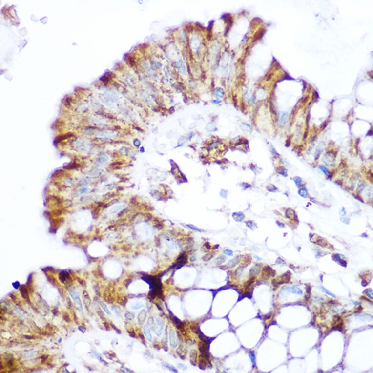 Immunohistochemistry - Anti-CARD15/NOD2 Antibody (A92467) - Antibodies.com