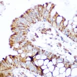 Immunohistochemistry - Anti-CARD15/NOD2 Antibody (A92467) - Antibodies.com