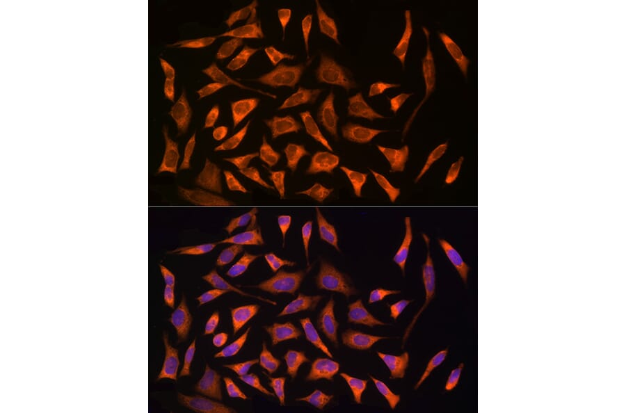 Immunofluorescence - Anti-CARD15/NOD2 Antibody (A92467) - Antibodies.com