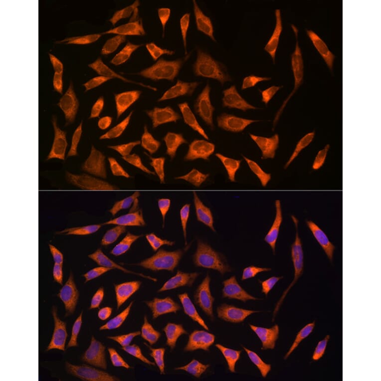 Immunofluorescence - Anti-CARD15/NOD2 Antibody (A92467) - Antibodies.com