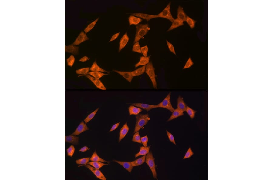Immunofluorescence - Anti-CARD15/NOD2 Antibody (A92467) - Antibodies.com