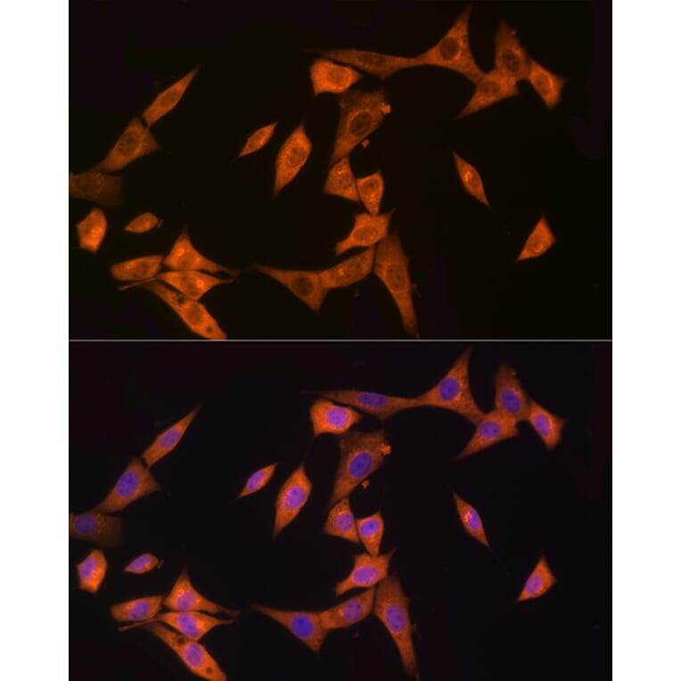 Immunofluorescence - Anti-CARD15/NOD2 Antibody (A92467) - Antibodies.com