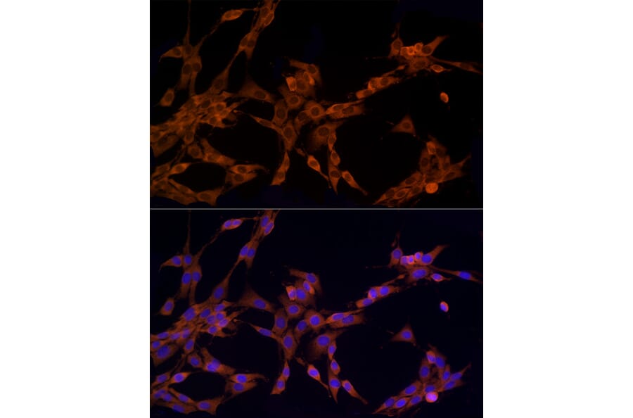 Immunofluorescence - Anti-CARD15/NOD2 Antibody (A92467) - Antibodies.com