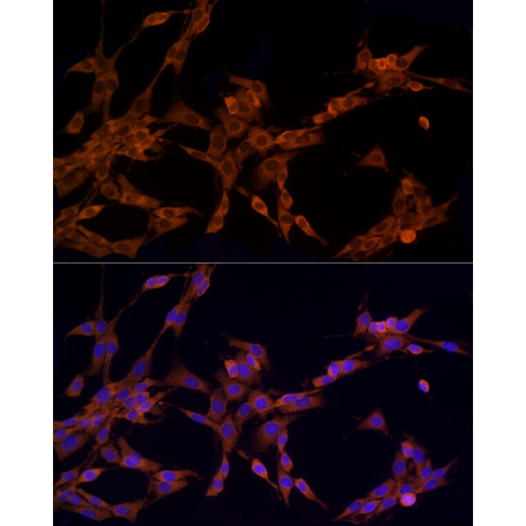 Immunofluorescence - Anti-CARD15/NOD2 Antibody (A92467) - Antibodies.com