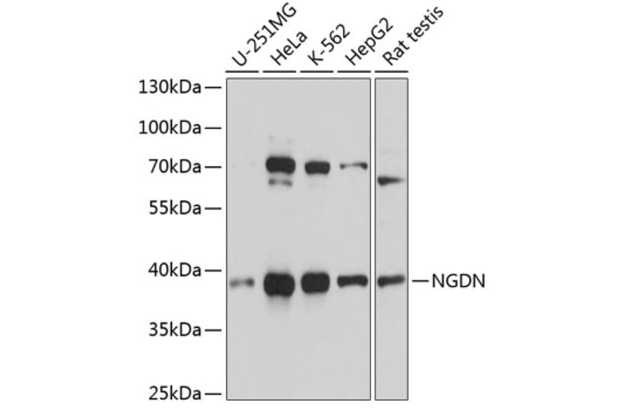 Western Blot - Anti-NGDN Antibody (A92468) - Antibodies.com