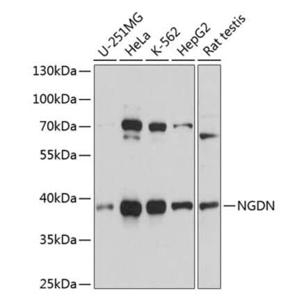 Western Blot - Anti-NGDN Antibody (A92468) - Antibodies.com