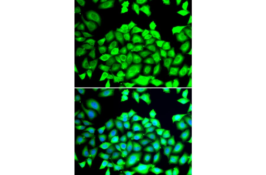 Immunofluorescence - Anti-CLCN7 Antibody (A12422) - Antibodies.com